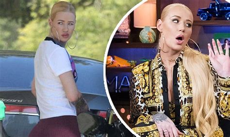 Plastic surgeon claims Iggy Azaleas bum implants。